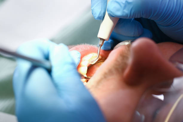 Best Emergency Dental Surgery in Freeburg, IL