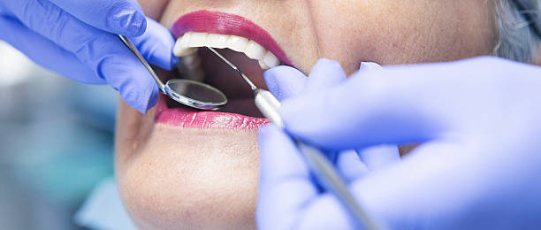 Best Emergency Tooth Extraction in Freeburg, IL